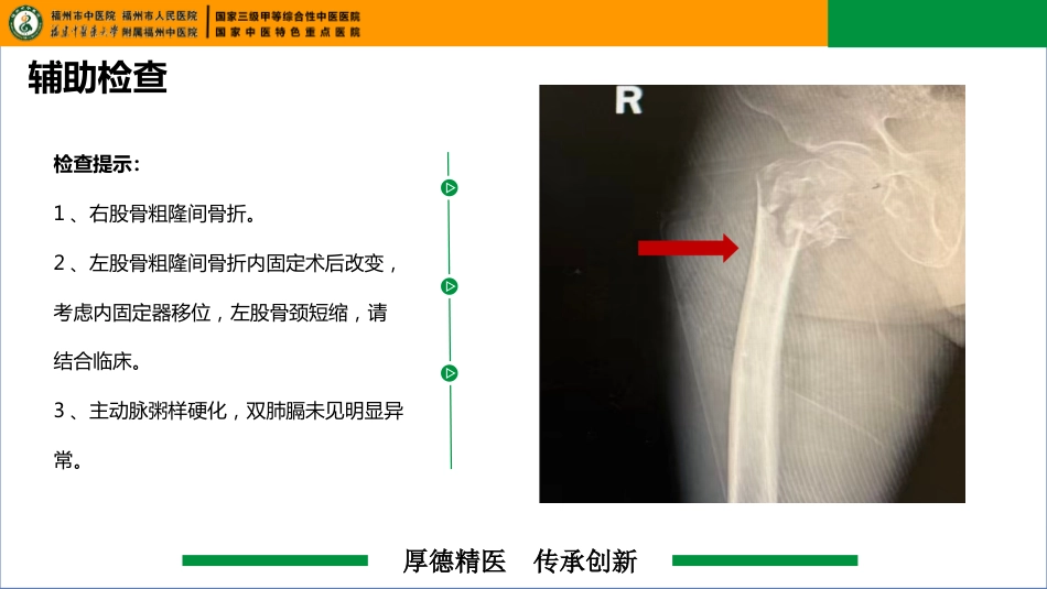 一例右股骨粗隆骨折合并左股骨内固定器移位患者的疑难病例讨论_第13页