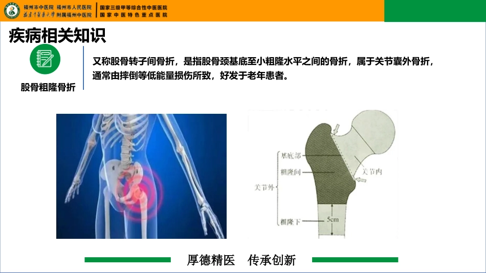 一例右股骨粗隆骨折合并左股骨内固定器移位患者的疑难病例讨论_第4页