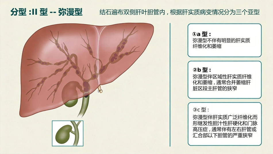 肝内胆管结石_第12页