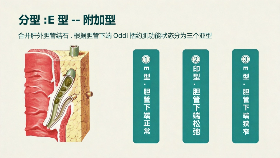肝内胆管结石_第13页