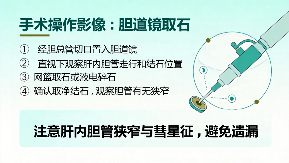 肝胆管结石的三镜联合治疗_第13页