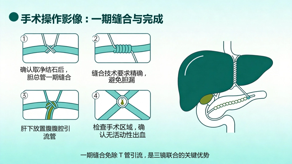 肝胆管结石的三镜联合治疗_第14页