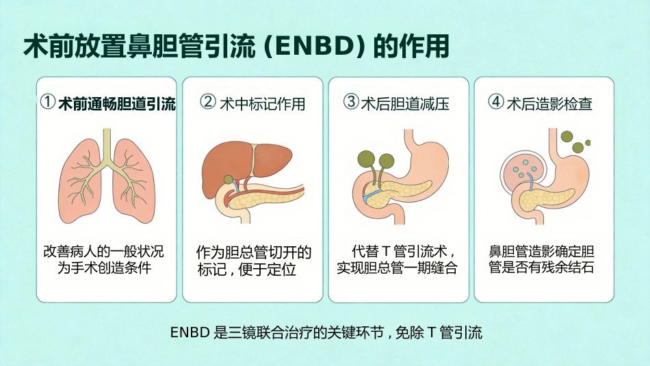 肝胆管结石的三镜联合治疗_第6页