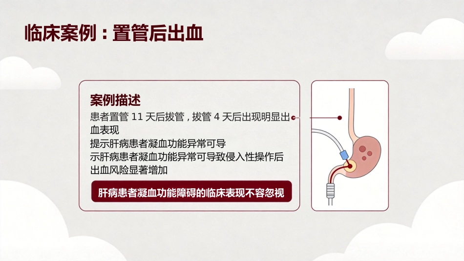 肝病患者的凝血改变_第2页