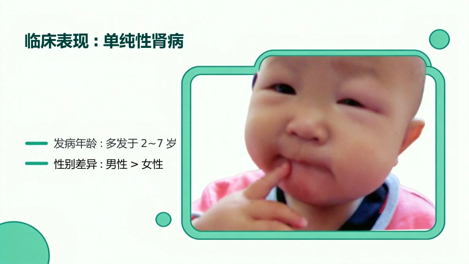 儿童肾病综合征_第9页