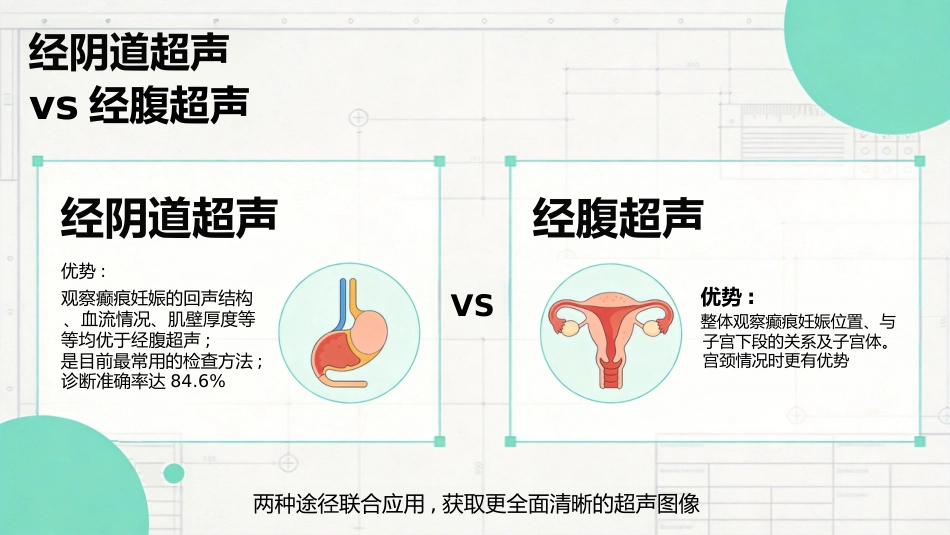 瘢痕妊娠的超声诊断_第13页