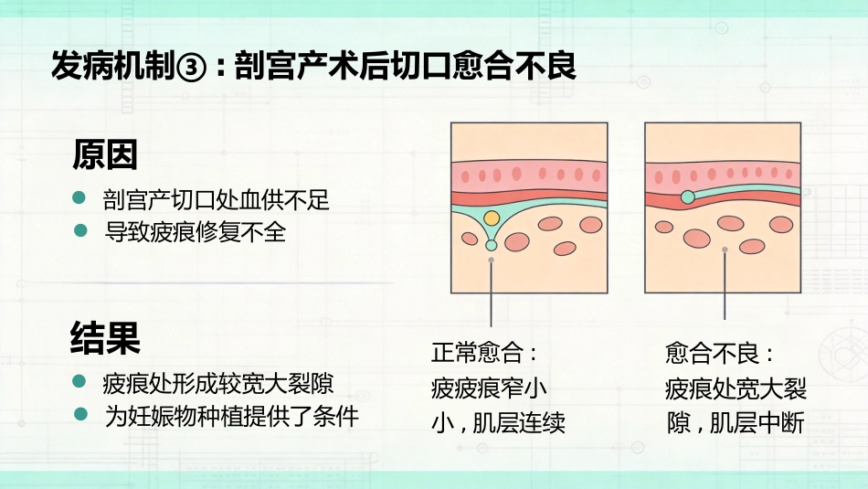 瘢痕妊娠的超声诊断_第7页