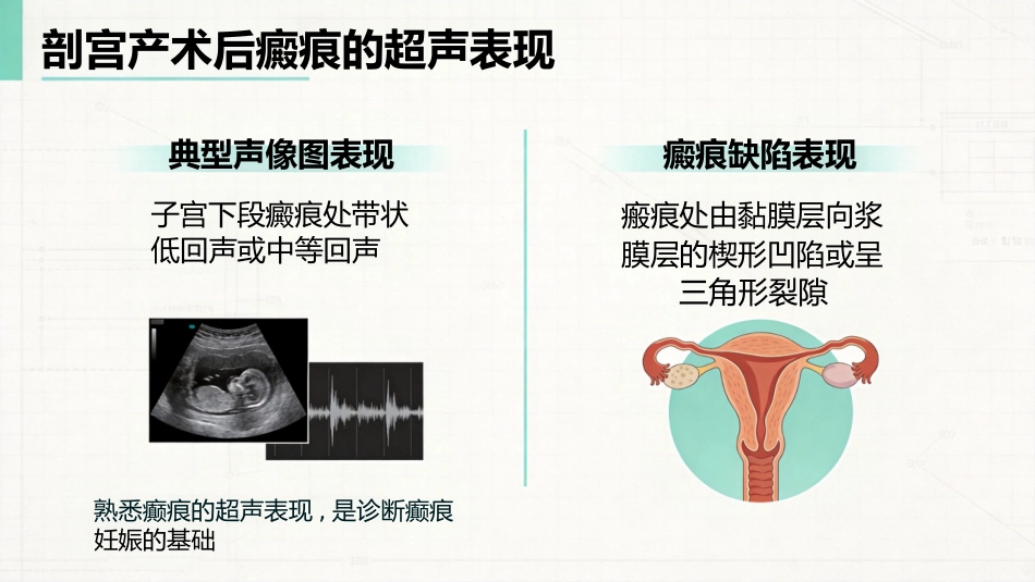 瘢痕妊娠的超声诊断_第8页
