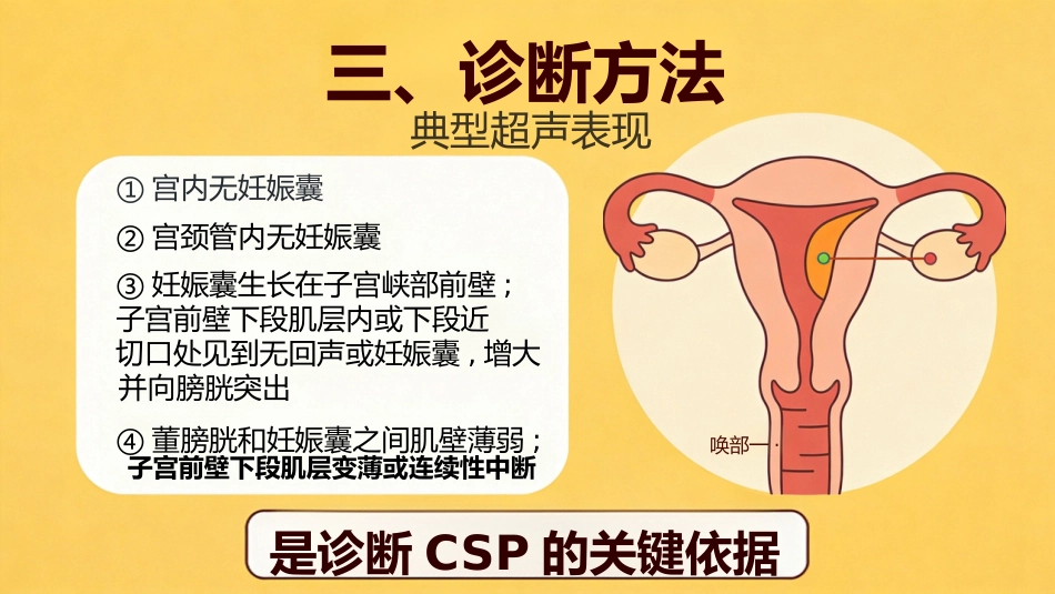 疤痕妊娠PPT课件_第8页