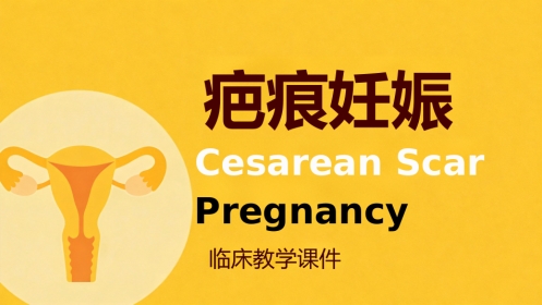 疤痕妊娠PPT课件
