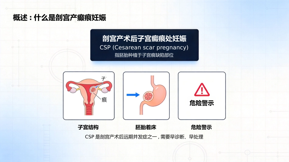 疤痕妊娠_第2页