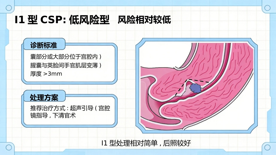 疤痕妊娠_第6页