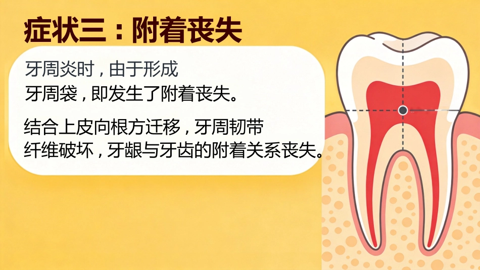 不可小觑牙周炎_第10页