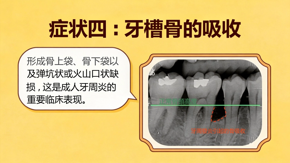 不可小觑牙周炎_第11页