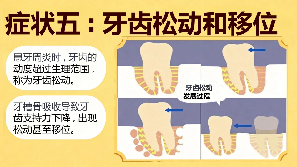 不可小觑牙周炎_第12页