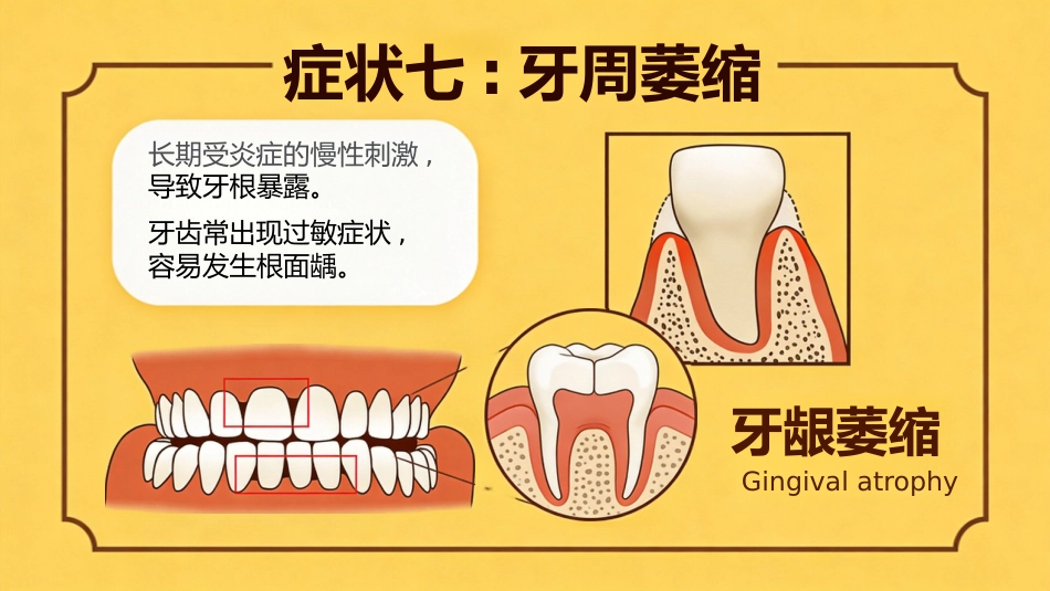 不可小觑牙周炎_第14页
