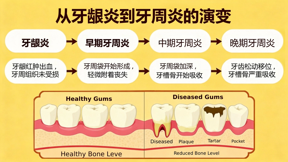 不可小觑牙周炎_第5页