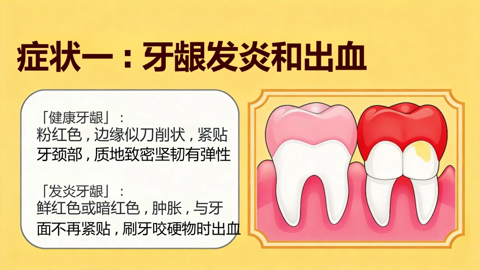 不可小觑牙周炎_第7页