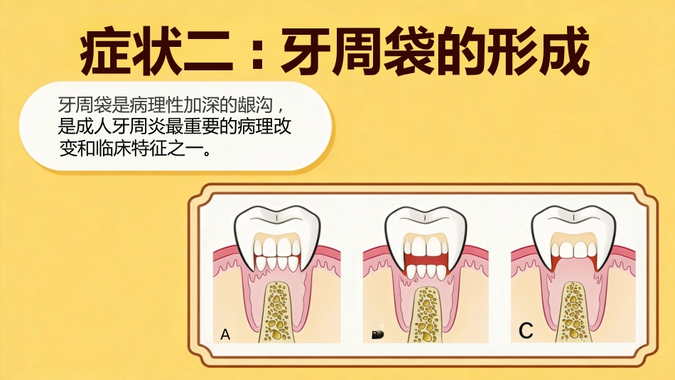不可小觑牙周炎_第9页