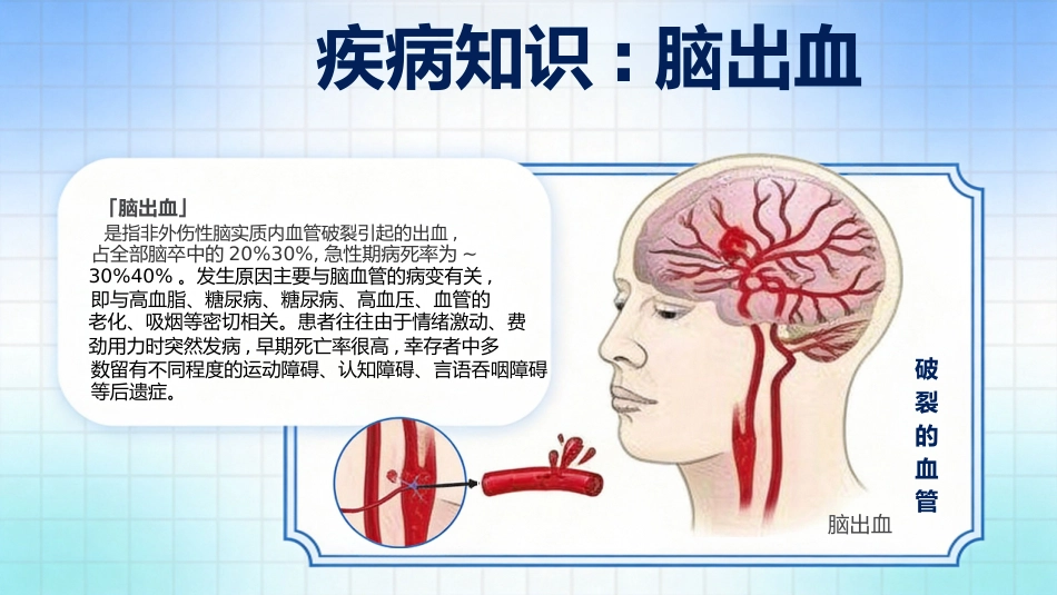脑出血护理查房个案汇报_第10页