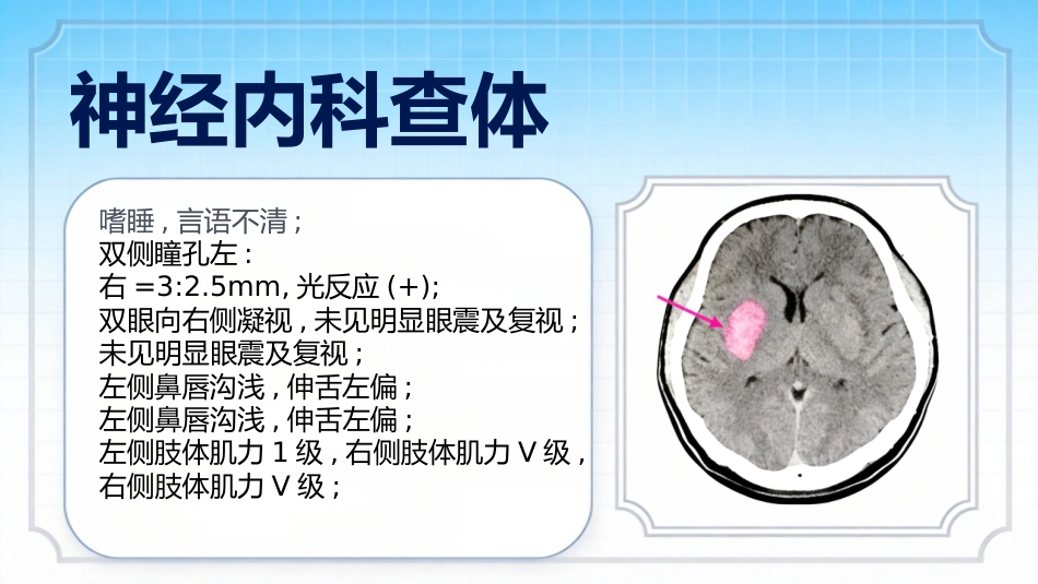 脑出血护理查房个案汇报_第8页