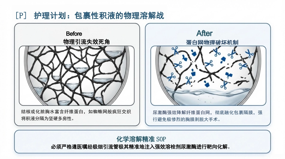 重症胸腔积液护理查房_第10页