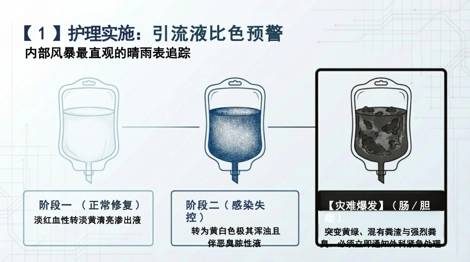 重症腹部感染护理查房_第13页