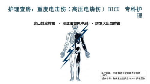 重症电击伤护理查房
