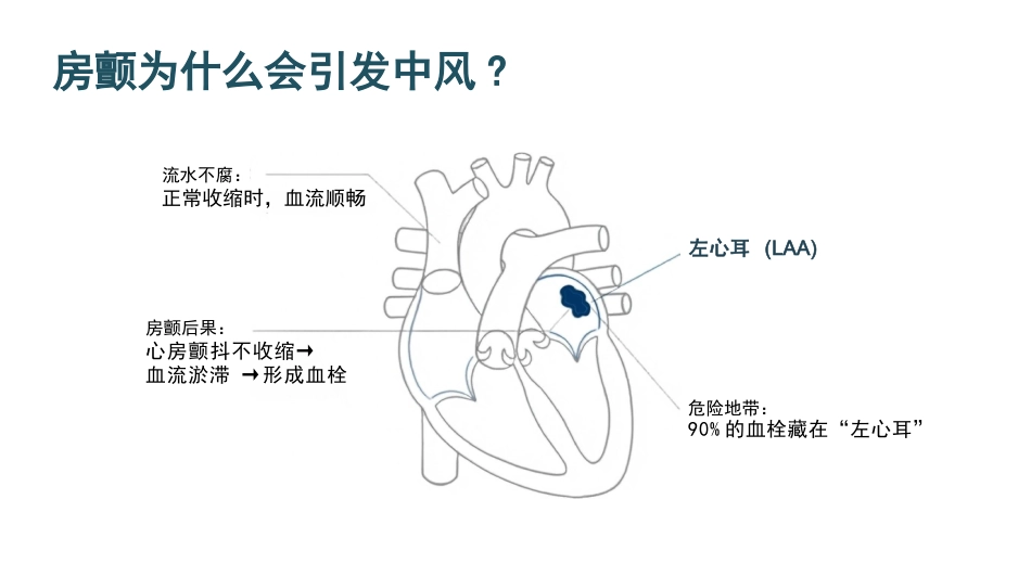 正确认识心房颤动_第7页