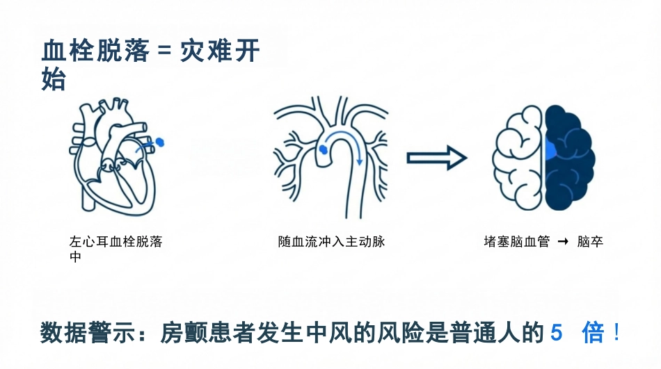 正确认识心房颤动_第8页