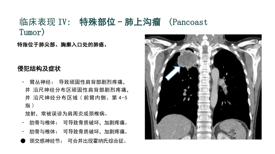 原发性支气管肺癌护理查房_第10页