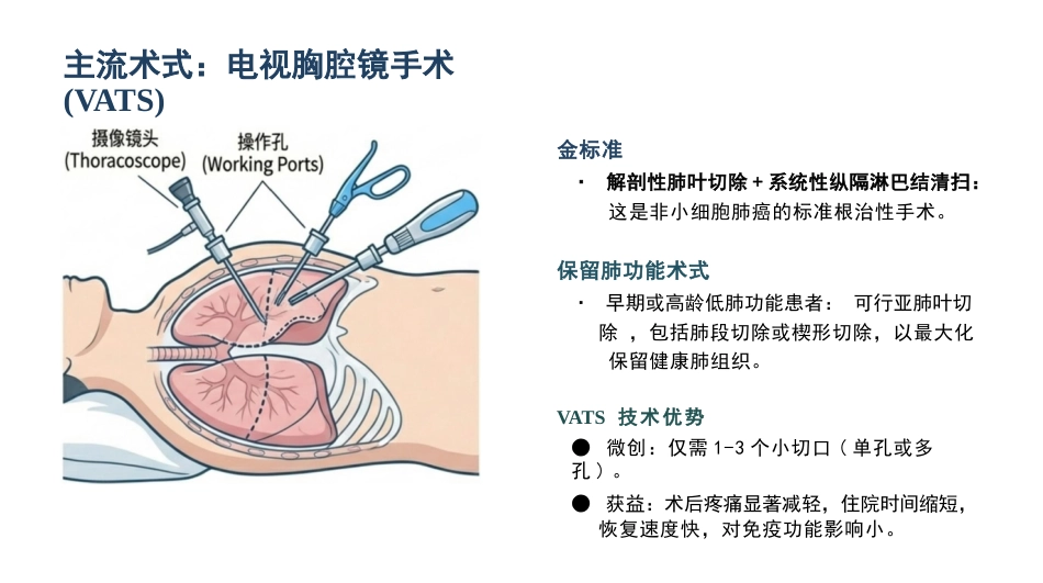 原发性支气管肺癌护理查房_第14页
