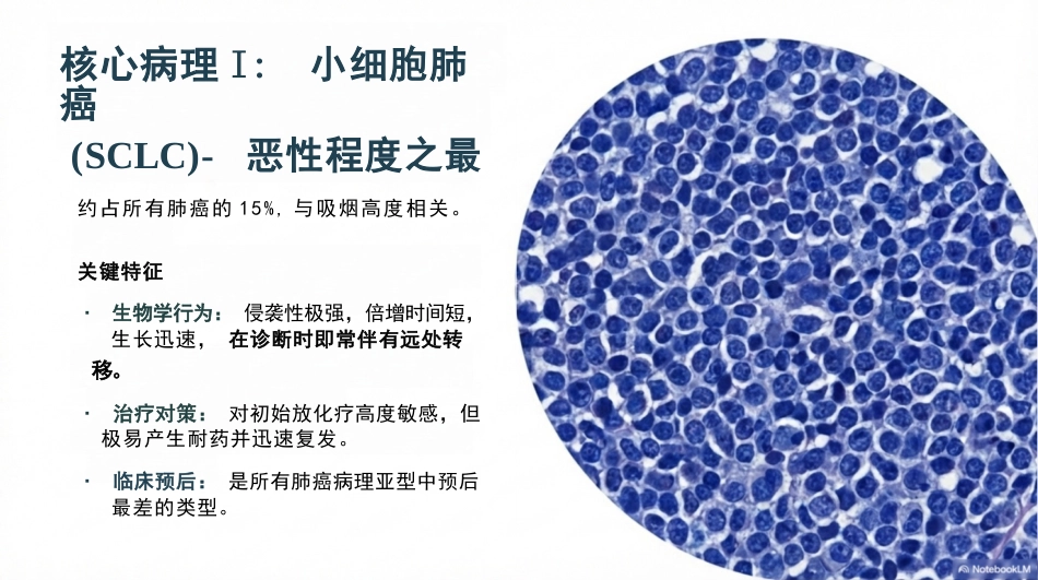 原发性支气管肺癌护理查房_第5页