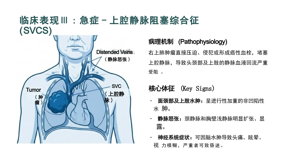原发性支气管肺癌护理查房_第9页