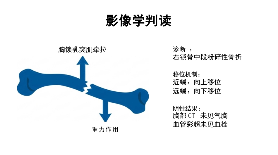 右锁骨骨折护理查房_第5页