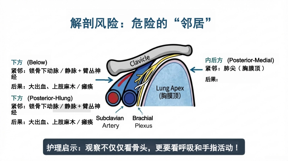 右锁骨骨折护理查房_第8页