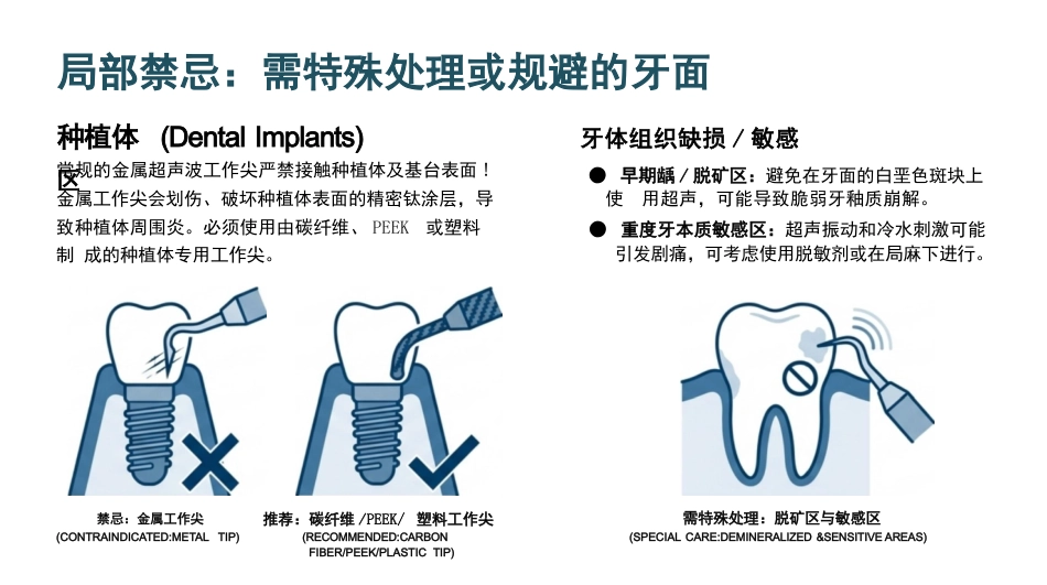 龈上洁治术_第10页