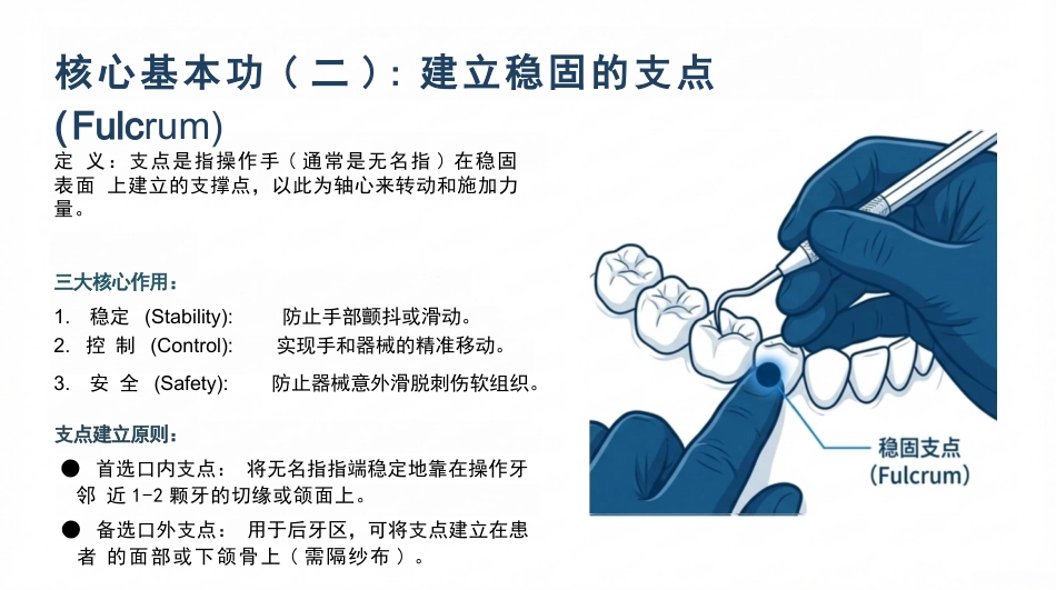 龈上洁治术_第14页