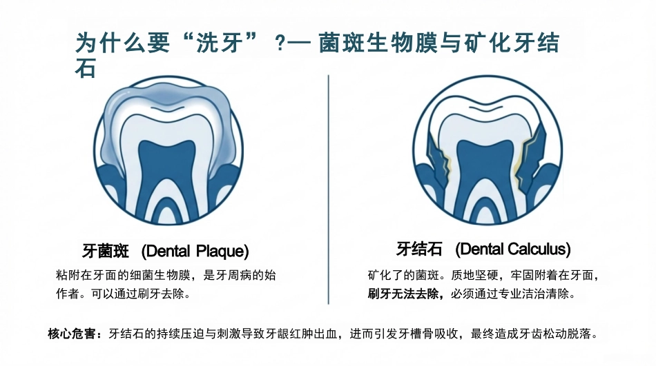 龈上洁治术_第3页