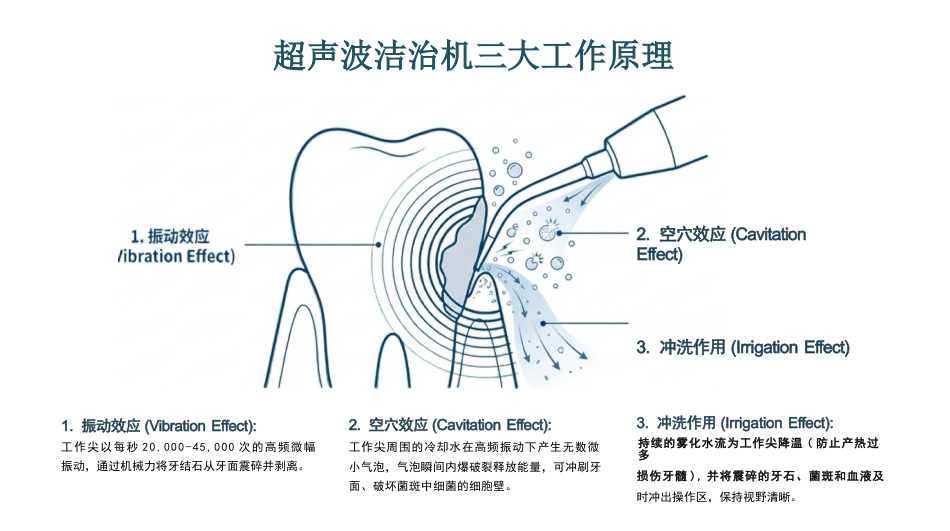 龈上洁治术_第6页