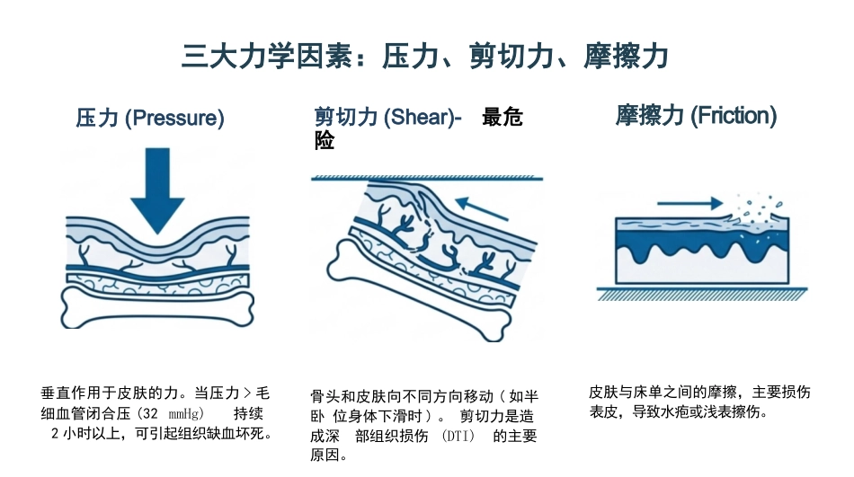 压力性损伤最新分期与护理_第4页