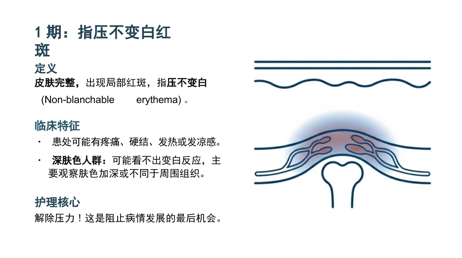 压力性损伤最新分期与护理_第7页
