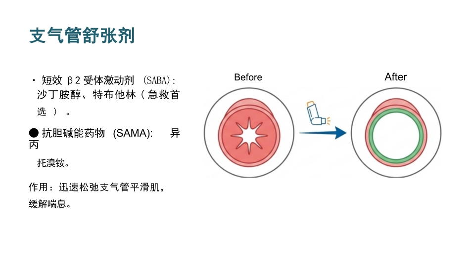 雾化吸入健康宣教_第10页