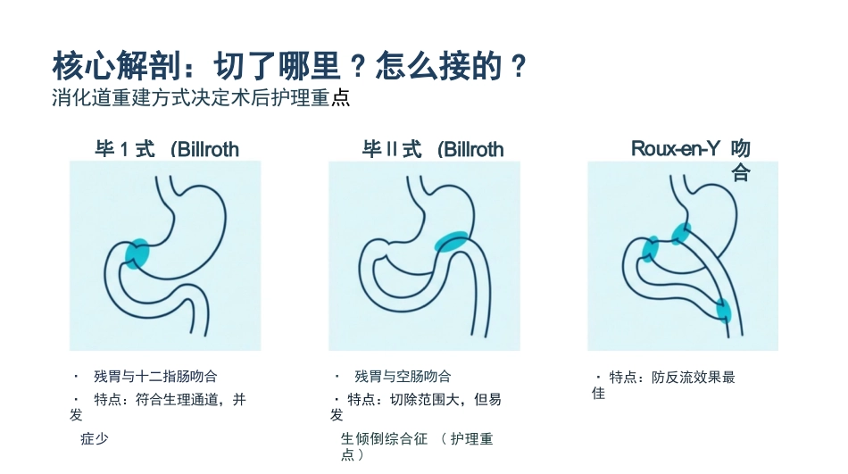 胃癌手术期护理查房_第4页