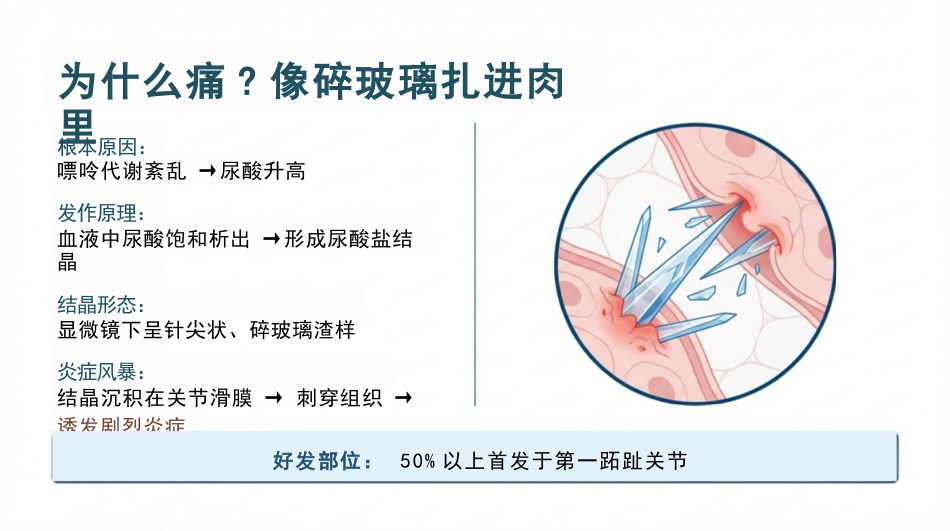 痛风患者护理查房_第3页