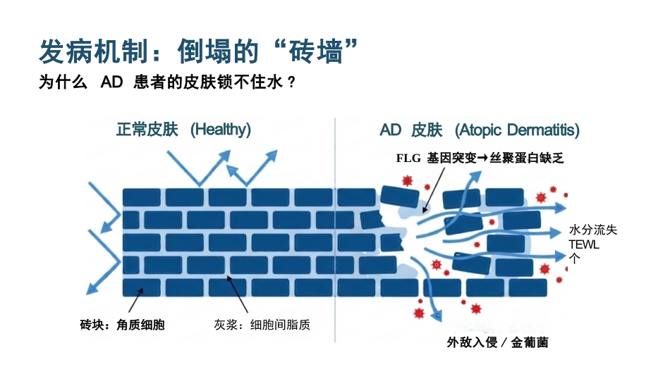 特应性皮炎护理_第5页