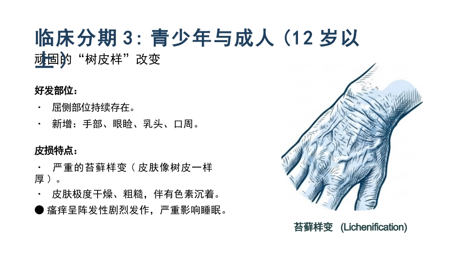 特应性皮炎护理_第9页