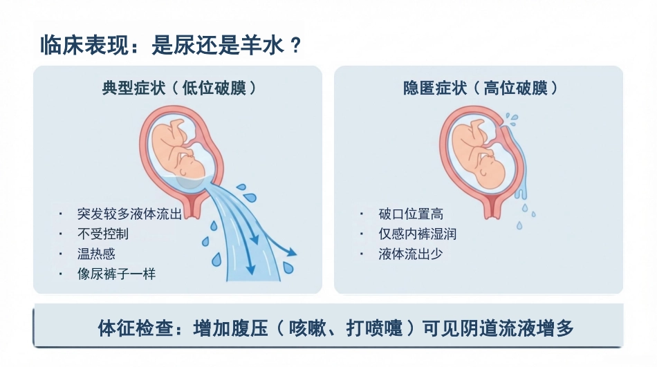 胎膜早破的护理查房_第5页