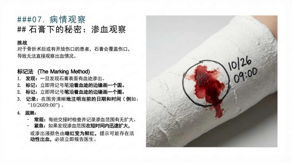 石膏固定术的护理查房_第13页