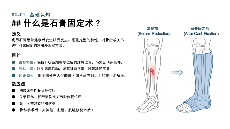 石膏固定术的护理查房_第3页